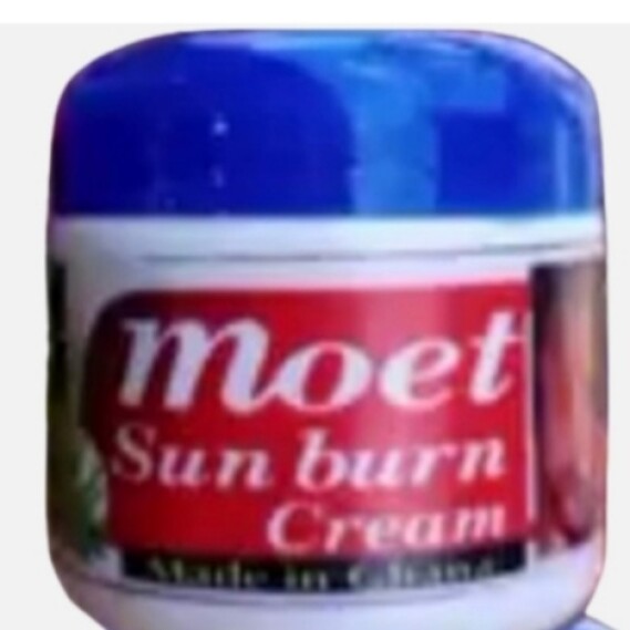 Moet Sun Burn Facial Cream